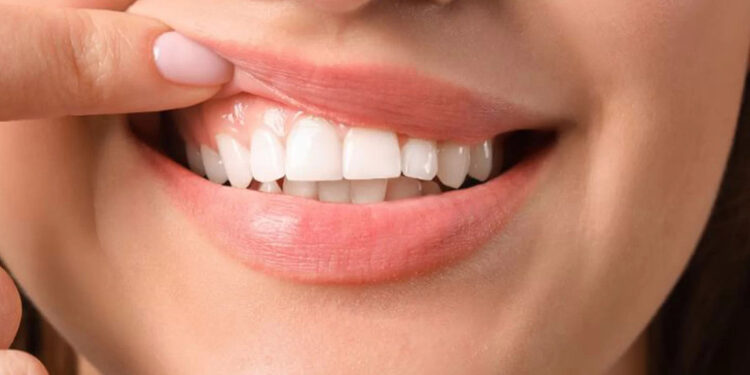 Ramazanda diş çürükleri artabilir