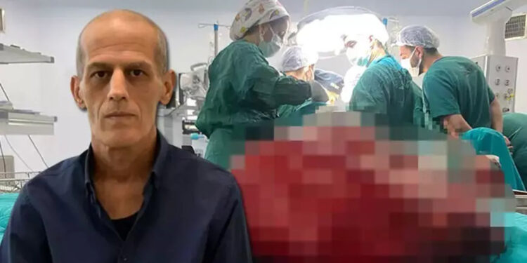 Böbrek ağrısıyla gitti, karnından 8 kiloluk tümör çıkarıldı