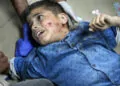 Gazze'de hayatını kaybeden sivillerin sayısı 33 bin 843