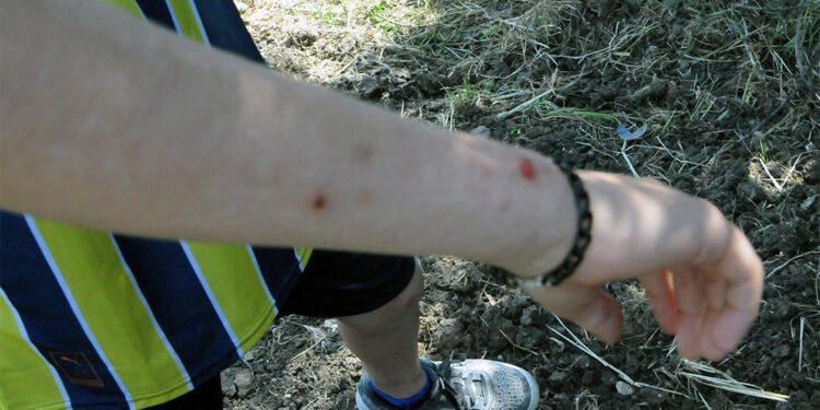 Hava sıcaklığının artması ile haşereler baş gösterdi