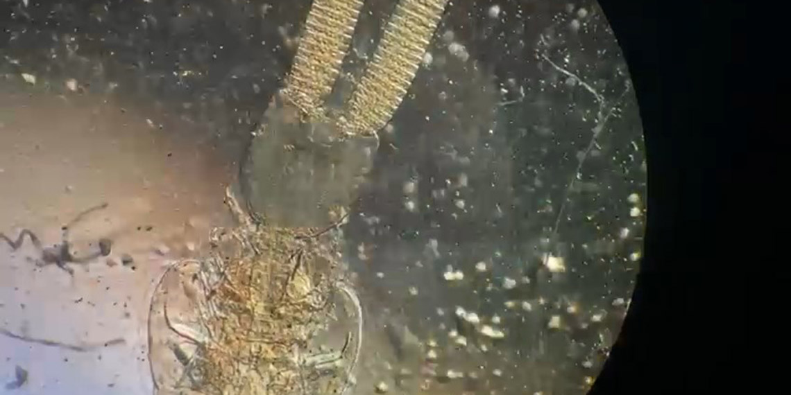 İzmir ve Saros körfezlerinde 2 yeni parazit türü keşfedildi