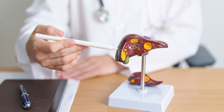 Karaciğer tümörlerinde radyoembolizasyon tedavisi nedir?