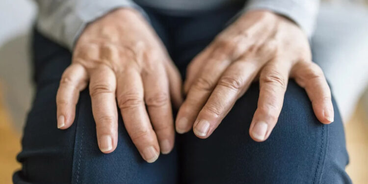 Kireçlenme, iltihaplı eklem romatizmasıyla karıştırılabilir