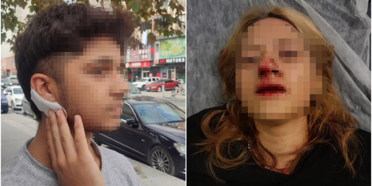 Parkta oturan genç sevgililere makasla saldırdı 