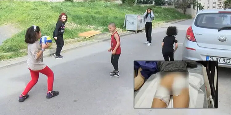 Sokak köpeklerinin saldırdığı 7 yaşındaki Çağrı'ya 30 dikiş atıldı