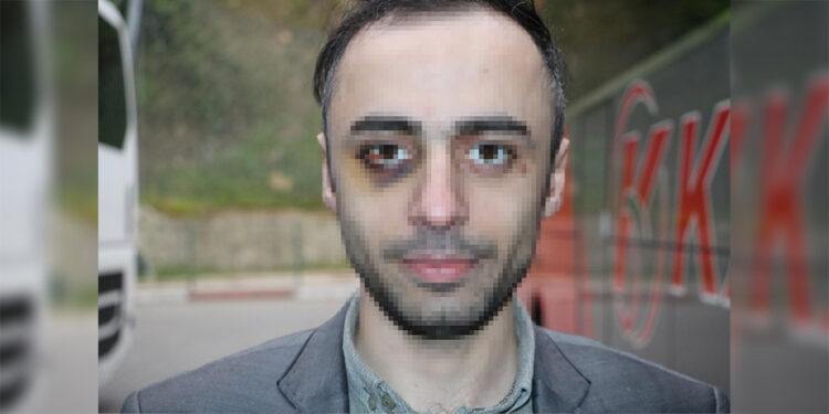 Üniversiteli gence tahta kaşıkla cinsel saldırı ve işkence