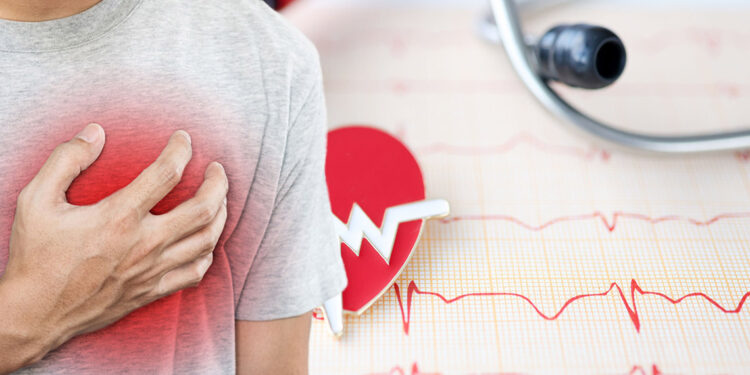 Aort anevrizması tesadüfen karşımıza çıkıyor