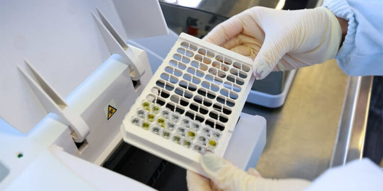 Brezilya'da sel sonrası su kaynaklı hastalık vakaları tespit edildi