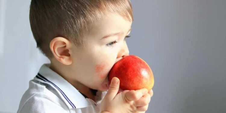 Çocuklarda besin alerjisi giderek artıyor