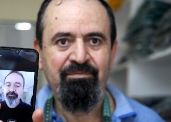 Kanser tedavisi gördü, beyaz saçı ve sakalı siyah uzadı