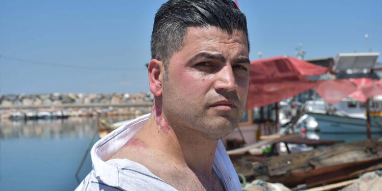 Lazer tedavisi sonrası 'yanık izi belirginleşti' suçlaması