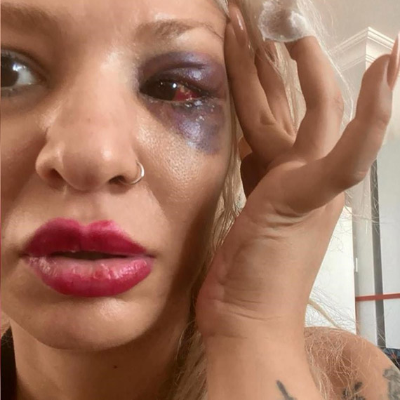 Yüzyüzeyken Konuşuruz'un gitaristi hakim karşısına çıktı