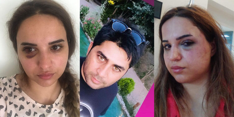 Bir yıldır boşanmak istediği eşi darbedip bıçakladı