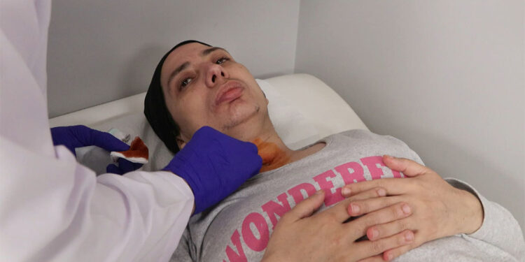 Beyin kanaması nedeniyle sesini kaybeden kadın konuşmaya başladı