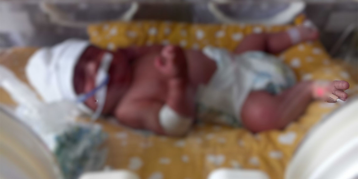 Sultanbeyli'de yaklaşık 10 ay önce özel bir hastanede doğum yapan Farangiz Ergashova'nın karnında unutulan gazlı bez, yaşadığı ağrılar nedeniyle gittiği hastanede çekilen tomografide ortaya çıktı ve ameliyatla alındı.