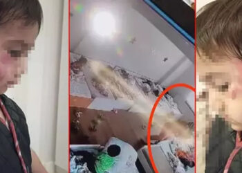 Anaokulunda dehşet! 4 yaşındaki çocuk arkadaşını uyurken 13 yerinden ısırdı