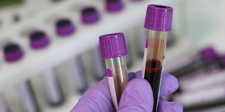 İngiliz hastanelerine siber saldırı sonrası, acil kan bağışı çağrısı