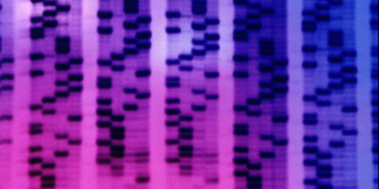 Prostat kanserinde erken teşhis için tükürük testi geliştirildi