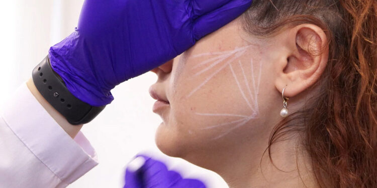 Ultraviyole ışınları kolajen seviyelerini neredeyse bitiriyor