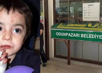 13 yaşındaki kelebek hastası Mert, hayatını kaybetti