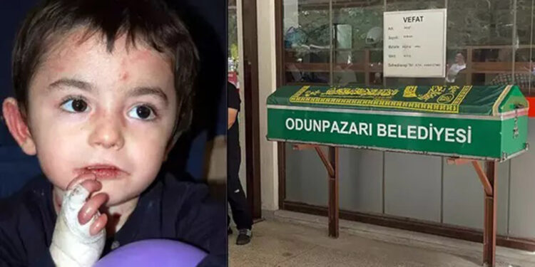 13 yaşındaki kelebek hastası Mert, hayatını kaybetti