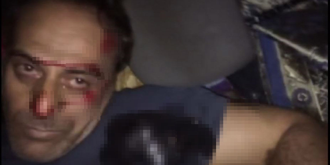 15 Temmuz'un felçli gazisi: O tanka yine çıkardım