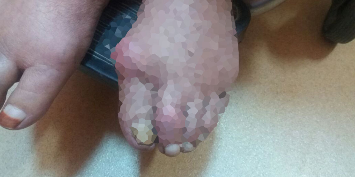 Diyarbakır Gazi Yaşargil Eğitim ve Araştırma Hastanesi Romatoloji Bölümü’nden Doç. Dr. Lütfi Akyol, ciğer tüketiminin çok olduğu ‘kebap diyarının hastalığı’ için uyarı.