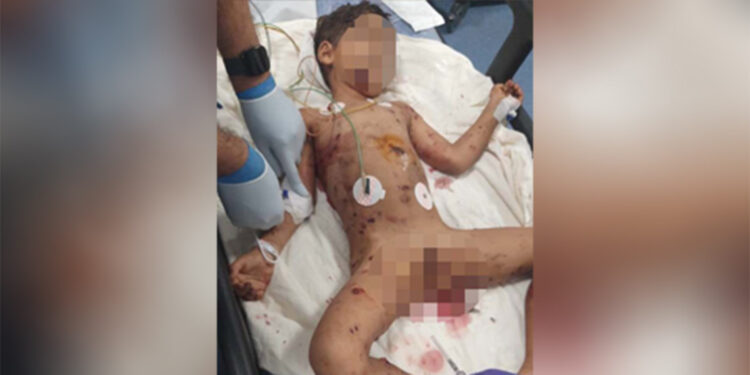 Adana'da 5 yaşındaki çocuğa köpek saldırısı: Durumu ağır