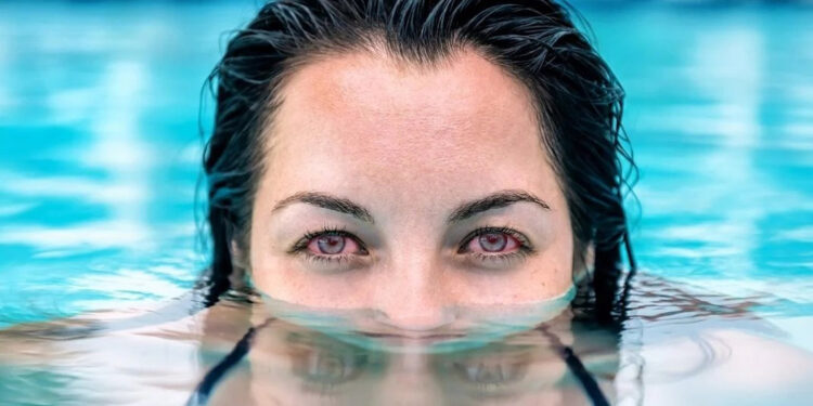 Hijyenik olmayan havuzlar göz enfeksiyonlarına neden olabilir