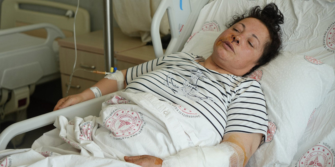 Niğde'de kadına saldıran Rottweiler cinsi köpeklerin sahibi serbest