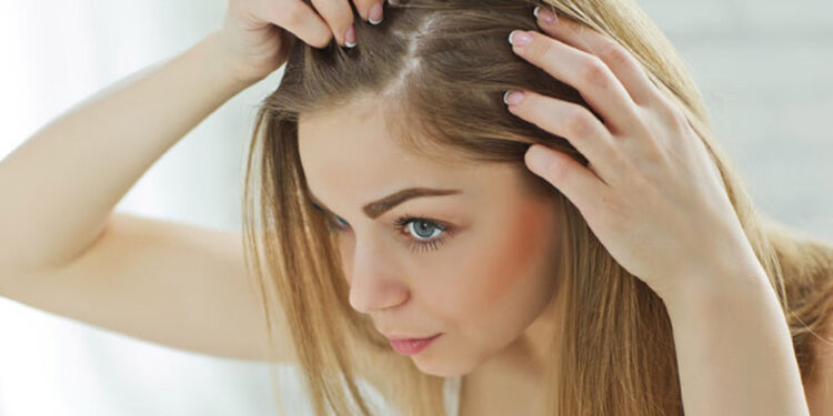 Polikistik over, kadınlarda saç dökülmesi yapabilir