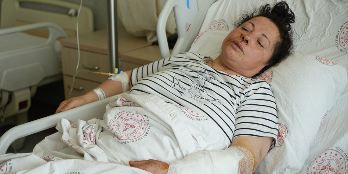 Rottweiler cinsi köpeklerin saldırısına uğrayan kadın yaralandı