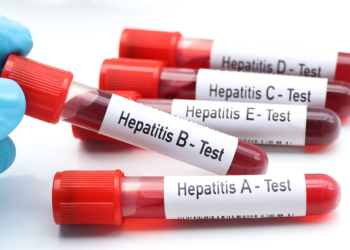Yakınlarında hepatit olanlar mutlaka taramadan geçmeli