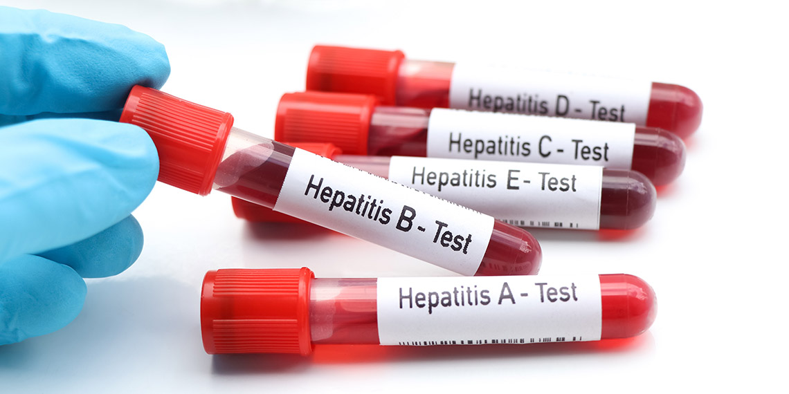 Yakınlarında hepatit olanlar mutlaka taramadan geçmeli