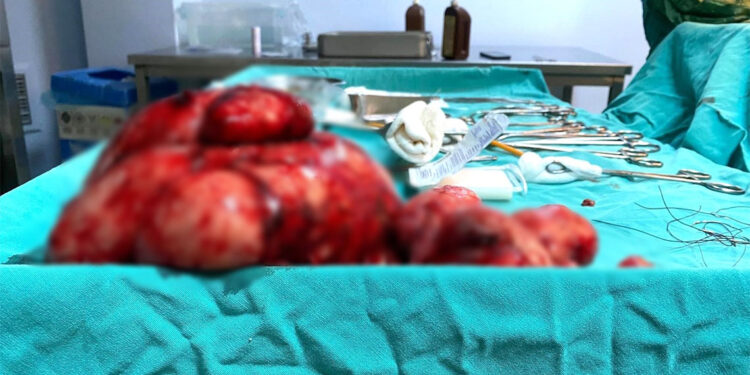 Yıllarca karnındaki 10 kiloluk kitleyle yaşamış