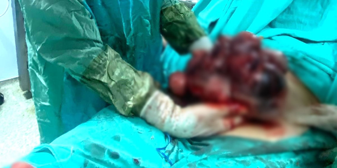 Adana’da yaşayan, 20 yıldır çocuk sahibi olma hayali kuran ve karın ağrısı şikayeti çeken G.D. yıllarca karnındaki 10 kiloluk kitleyle yaşamış.