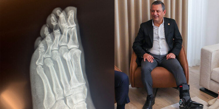 Özgür Özel ayağından vuruldu iddialarına yanıt verdi