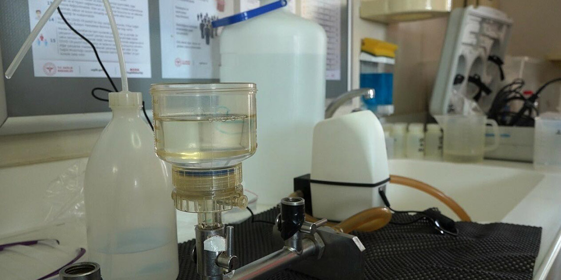 Balık ölümleri ve kötü kokunun sebebi, İzmir yangınları da olabilir