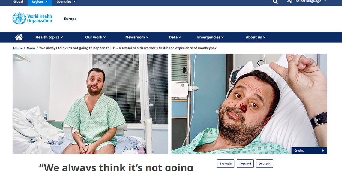 DSÖ'nün 'Farkındalık yüzü' Harun Tulunay: Mpox ızdırabım oldu