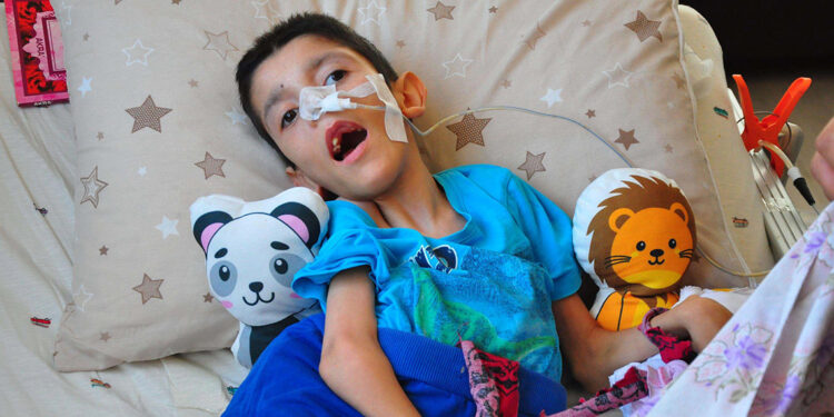 Hidrosefali hastası Osmancan, yaşından çok ameliyat geçirdi