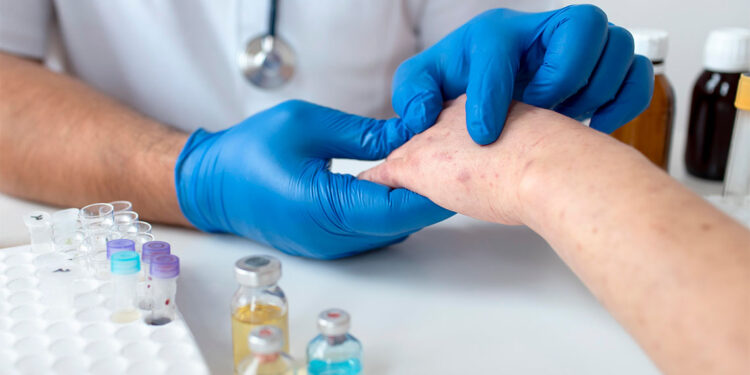 Kocaeli Şehir Hastanesi'nde M-Çiçeği vakası mı var?