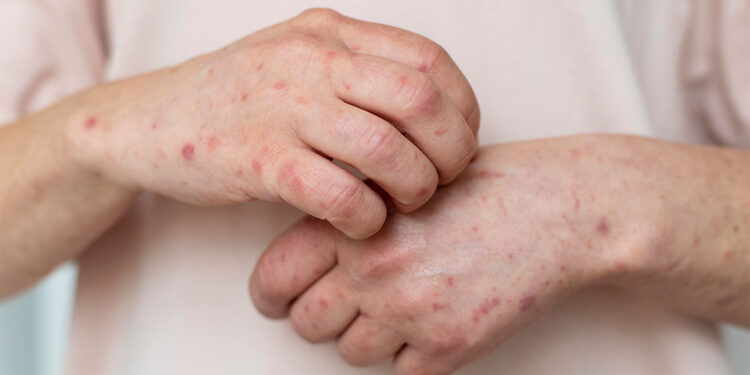 11 ülkeden gelen uçuşlar yakın takibe alındı