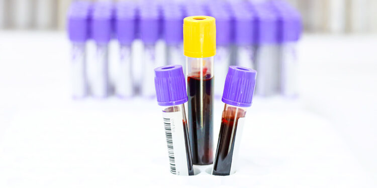 1 milyondan fazla kök hücre bağışçısı adayına ulaşıldı