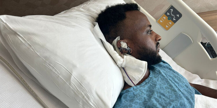 Kavgada kulağı kopan hastaya yeni kulak