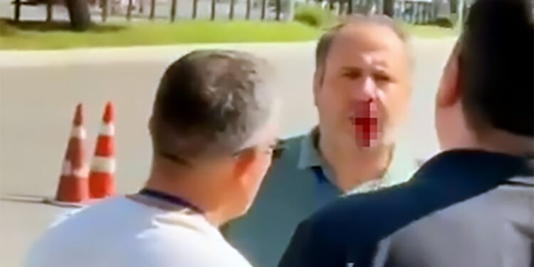 Eşi direksiyon sınavını geçemeyince görevli öğretmenin burnunu kırdı