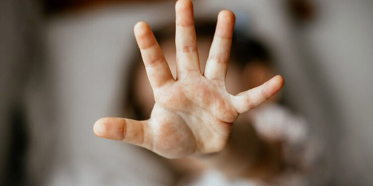 Tekirdağ'da cinsel istismara uğrayan bebekle ilgili tutuklu sayısı 5'e çıktı