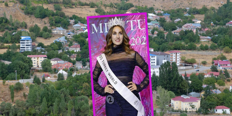 Yayladere, ‘Türkiye güzeli’ doktoru bekliyor