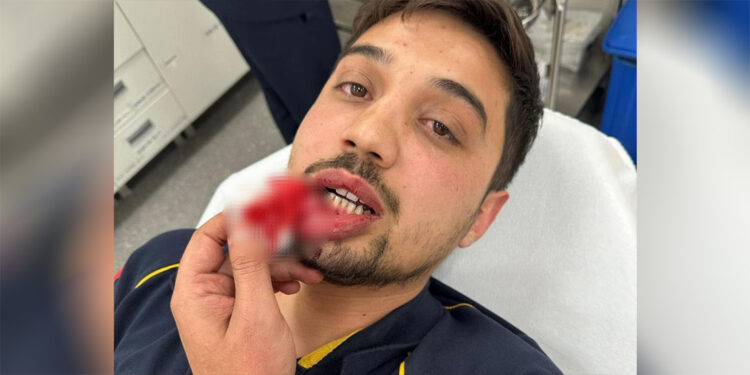 Baba ile oğlu, hasta taşıyan ambulansın önünü kesip sürücüyü darbetti