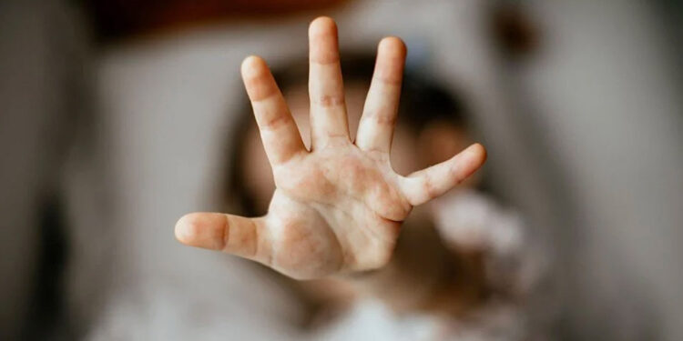 Batman'daki çocuk istismarında takipsizlik kararına itiraz