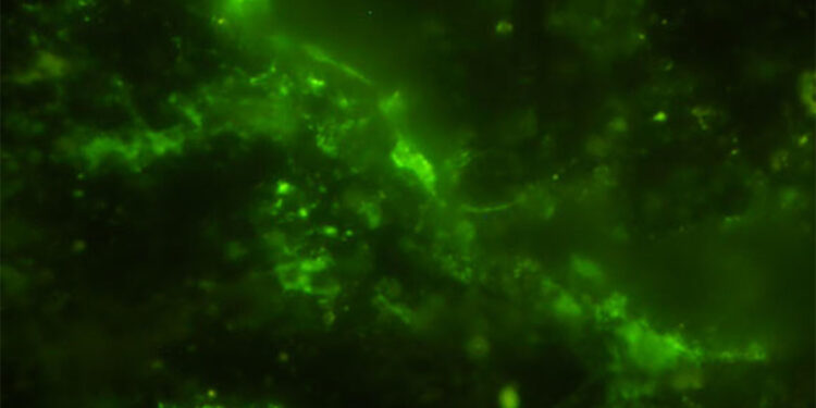 2 milyar yıl öncesine ait mikrop keşfedildi